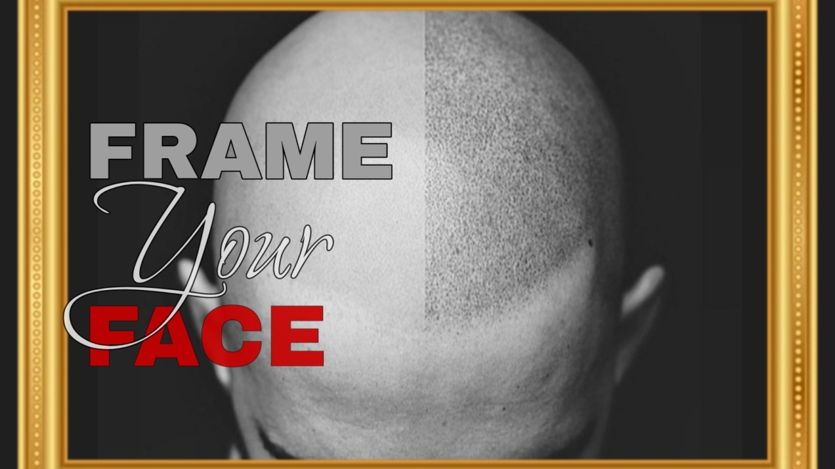 Scalp Micropigmentation (SMP)